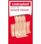 Leukoplast Leukosan Strips 6 x 38 mm (6 strips) 6 x 75 mm (3 strips) (9st) 9st thumb